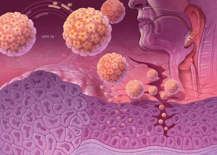 Είσοδος του HPV στο ανθρώπινο σώμα